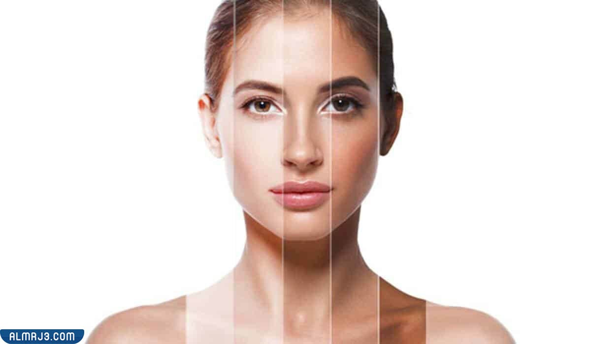 تجربتي مع توحيد لون الجسم بالليزر