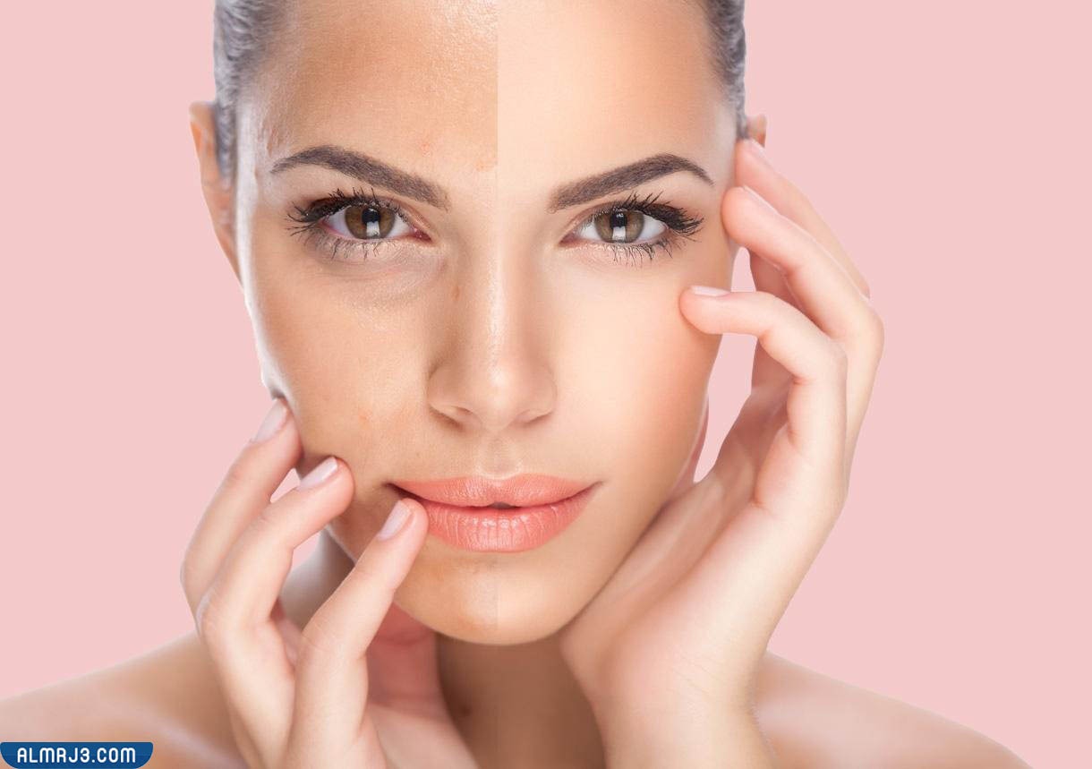 توحيد لون الجسم وتبيضه