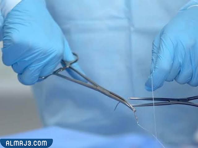 كيف أعرف أني متوسعة بعد الأربعين؟