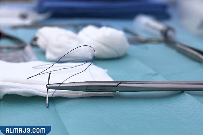 كيف اعرف ان خياطتي بعد الولادة ممتازه وضيقه؟