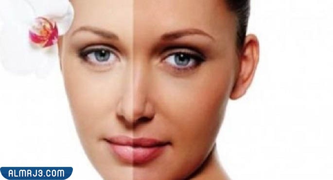 تعليمات ضرورية بعد جلسة التقشير