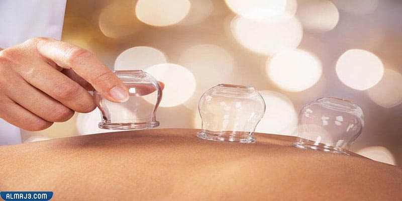 شروط الحجامة 