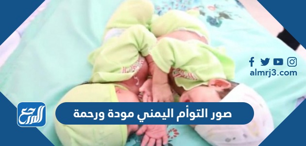 صور التوأم اليمني مودة ورحمة