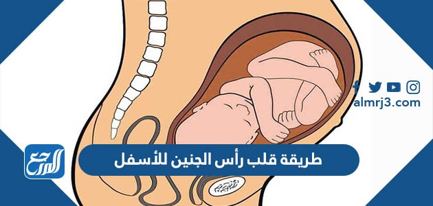 طريقة قلب رأس الجنين للأسفل