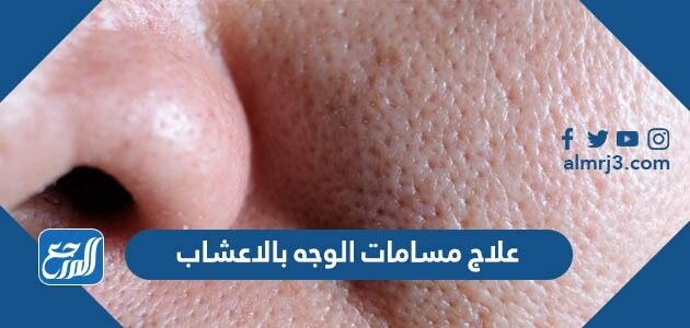 علاج مسامات الوجه بالاعشاب مجرب