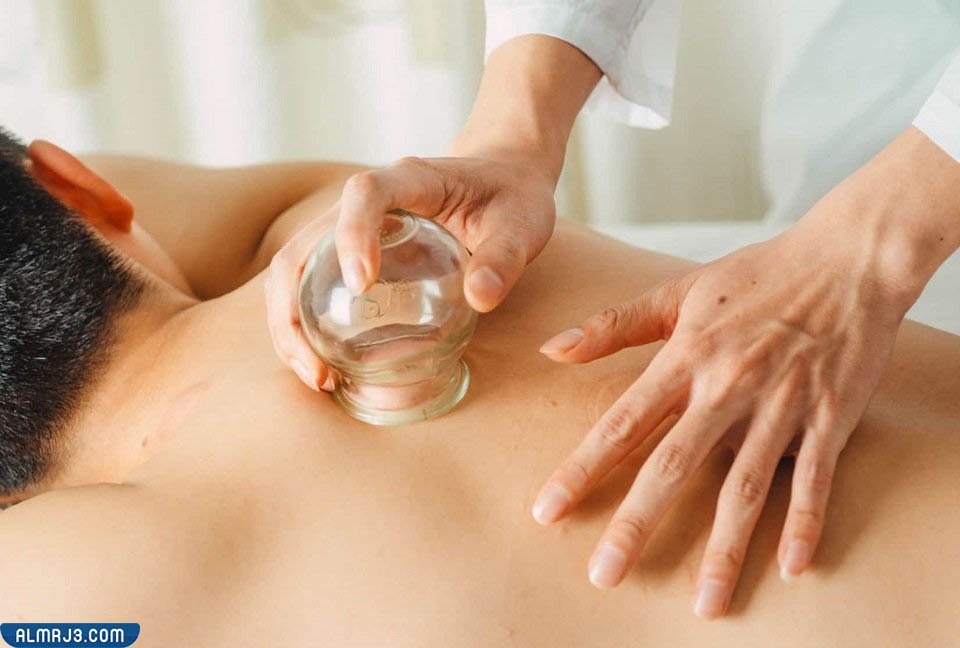 فوائد إجراء الحجامة 
