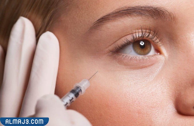 سعر حقن الفيلر تحت العين