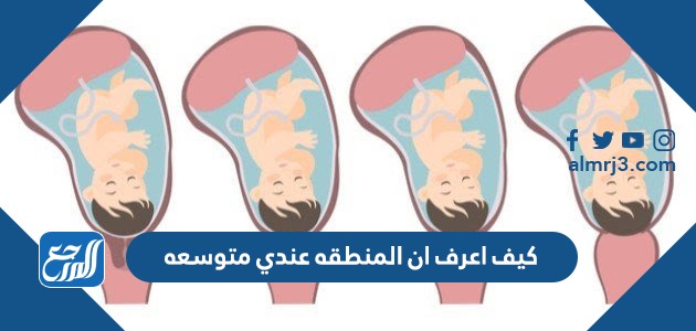 كيف اعرف ان المنطقه عندي متوسعه