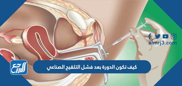 كيف تكون الدورة بعد فشل التلقيح الصناعي