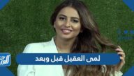 لمى العقيل قبل وبعد