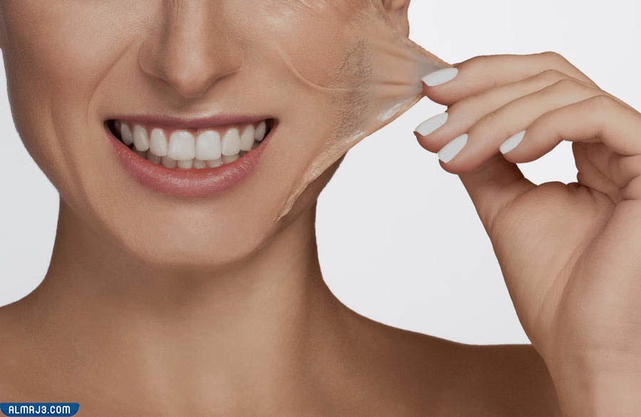 ما هو التقشير الكيميائي في المنزل 