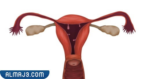 ما هي عملية تضييق المهبل 
