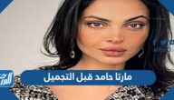 صور مارتا حامد قبل التجميل