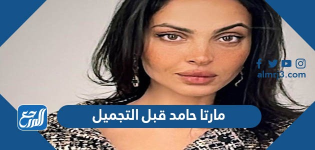مارتا حامد قبل التجميل