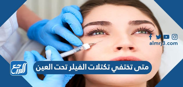 متى تختفي تكتلات الفيلر تحت العين