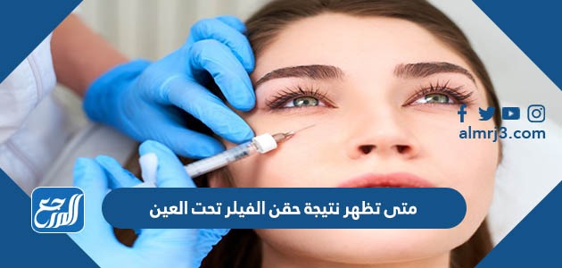 متى تظهر نتيجة حقن الفيلر تحت العين