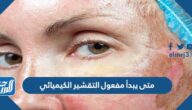متى يبدأ مفعول التقشير الكيميائي