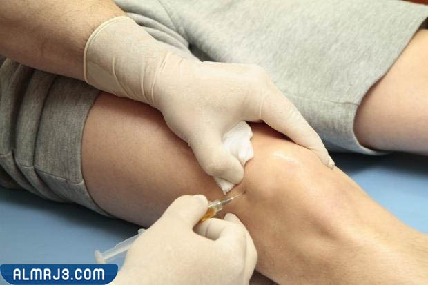 متى يبدأ مفعول الكورتيزون في الجسم 