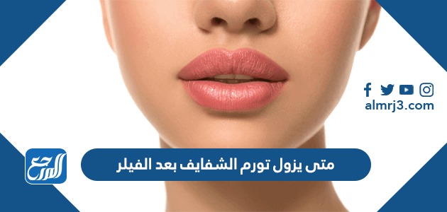 متى يزول تورم الشفايف بعد الفيلر