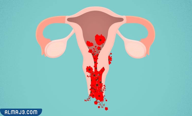 متى يكون نزيف الرحم خطير 