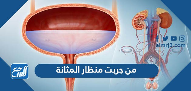 من جربت منظار المثانه