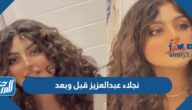 نجلاء عبدالعزيز قبل وبعد