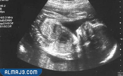 تطور الجنين في الشهر الثالث من الحمل 