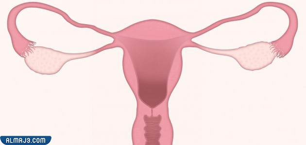 عملية ربط الرحم مع الولادة القيصرية