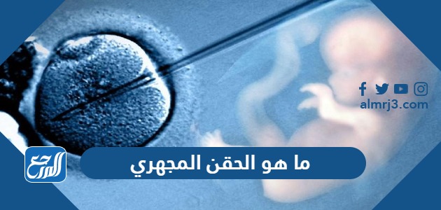 ما هو الحقن المجهري