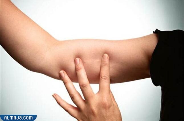 الآثار الجانبية الناتجة عن شريحة منع الحمل