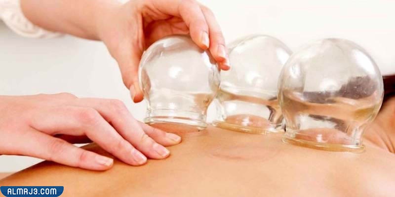 العلاج بالحجامة لتحسين العلاقة الزوجية