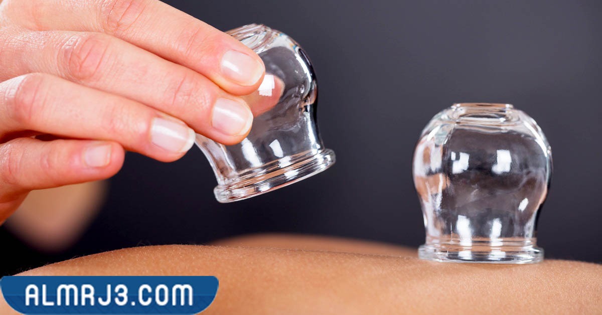 مضاعفات عملية الحجامة