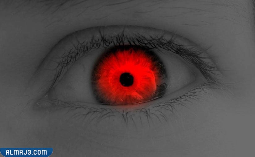 كيف اعرف من اصابني بالعين؟