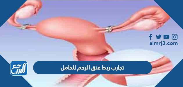 تجارب ربط عنق الرحم للحامل