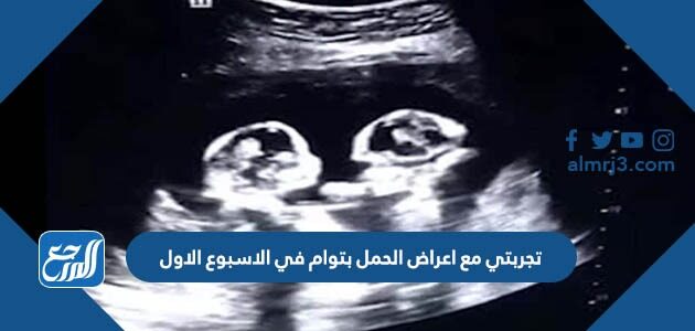 تجربتي مع اعراض الحمل بتوام في الاسبوع الاول