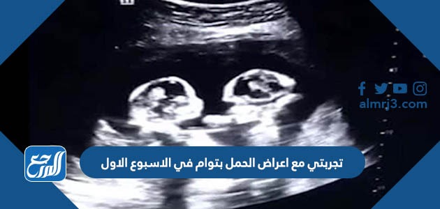 تجربتي مع اعراض الحمل بتوام في الاسبوع الاول