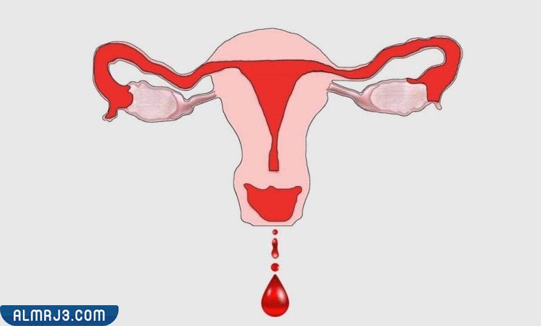 تجربتي مع تنظيف الرحم من الدم المتجلط 