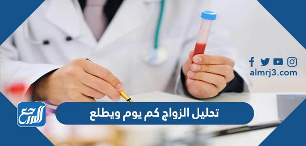 تحليل الزواج كم يوم ويطلع