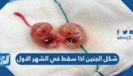 شكل الجنين اذا سقط في الشهر الاول بالصور