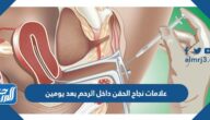علامات نجاح الحقن داخل الرحم بعد يومين