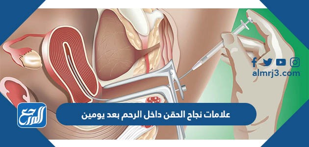 علامات نجاح الحقن داخل الرحم بعد يومين