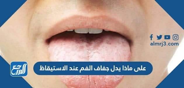 على ماذا يدل جفاف الفم عند الاستيقاظ