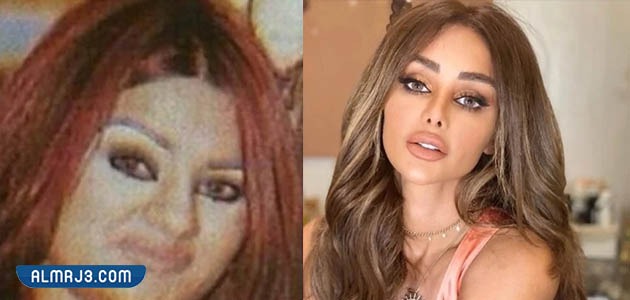 عهود العنزي قبل وبعد