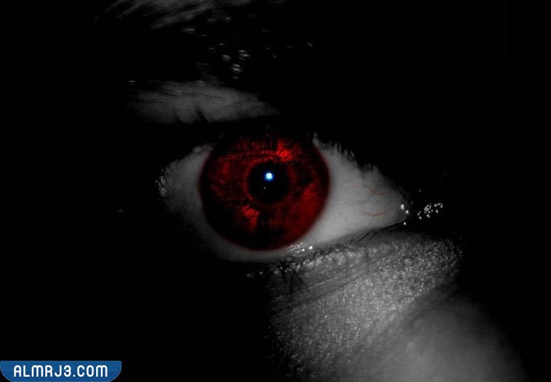 هل الإصابة بالعين تؤدي إلى الموت؟