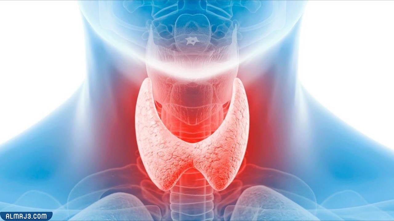 ما العوامل التي تؤثر في علاج قصور الغدة الدرقية؟
