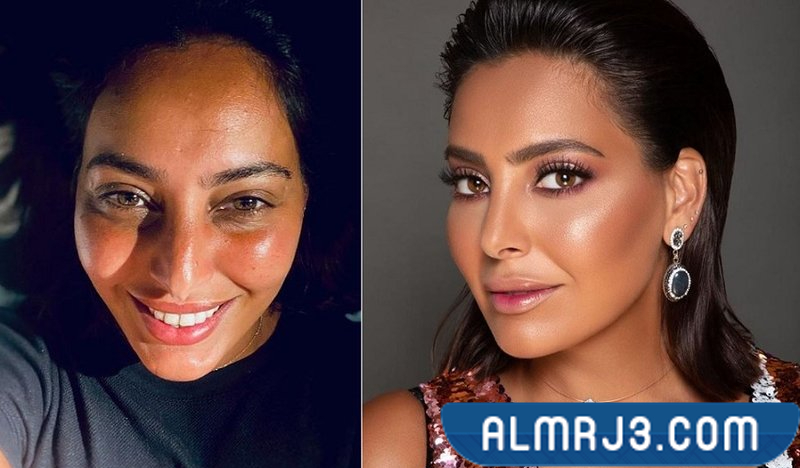 فاطمة الصفي قبل وبعد (1)