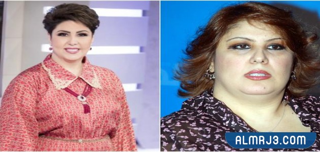 فجر السعيد قبل وبعد التجميل