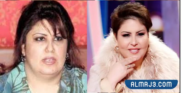 فجر السعيد قبل وبعد التجميل