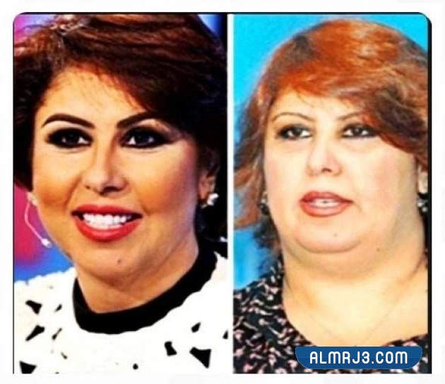 فجر السعيد قبل وبعد التجميل