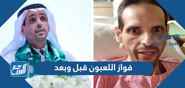 فواز اللعبون قبل وبعد